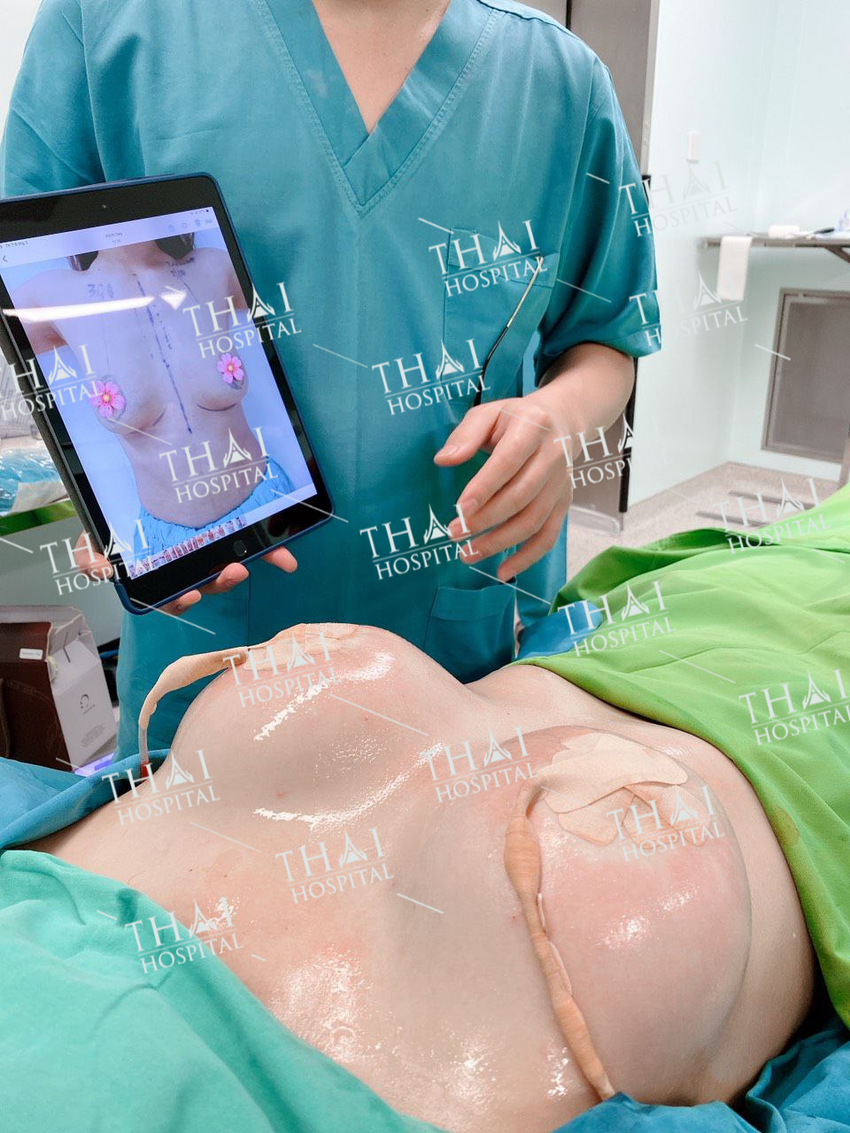 Sở hữu vòng 1 đẹp như mơ sau khi tiến hành nâng ngực sửa túi tại THAI Hospital