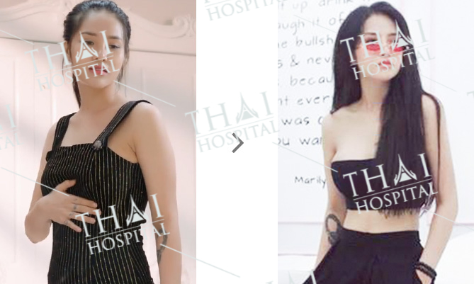 Sở hữu đường cong quyến rũ với 3 vòng siêu chuẩn tại THAI Hospital